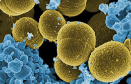 Bakteriyaların antibiotiklərə qarşı müqavimət qazanması nə üçün təkamülə dəlil deyil?